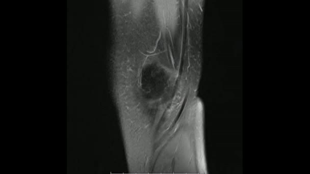 Imágenes de resonancia magnética de la articulación de la rodilla Densidad de protones sagital Imágenes en modo cine (MRI) que muestran la anatomía de la rodilla - Metraje, vídeo