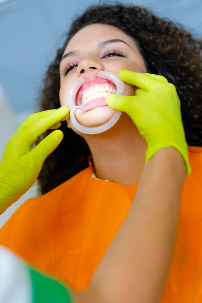 Menina adolescente de raça mista com afastador de bochechas dentárias na boca e mãos de dentista verificando
 - Foto, Imagem