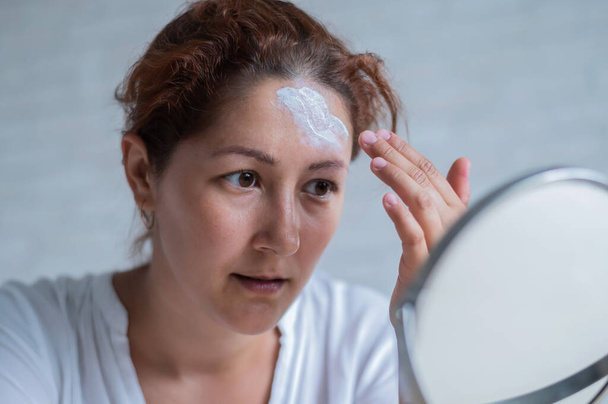 Portrait of a Caucasian woman with vitiligo uses sunscreen. A girl with a white pigment spot on her forehead looks in the mirror and is smeared with cream. - Foto, Imagem