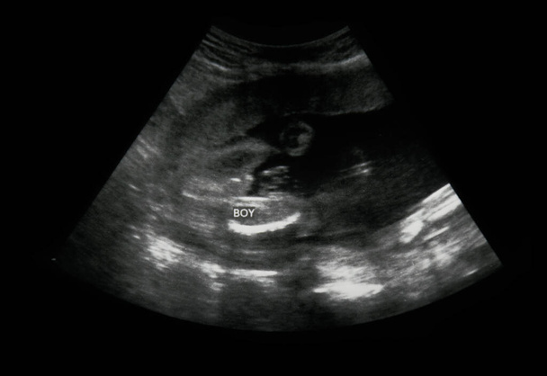 Ultrasound of baby in mother's womb. - Photo, Image