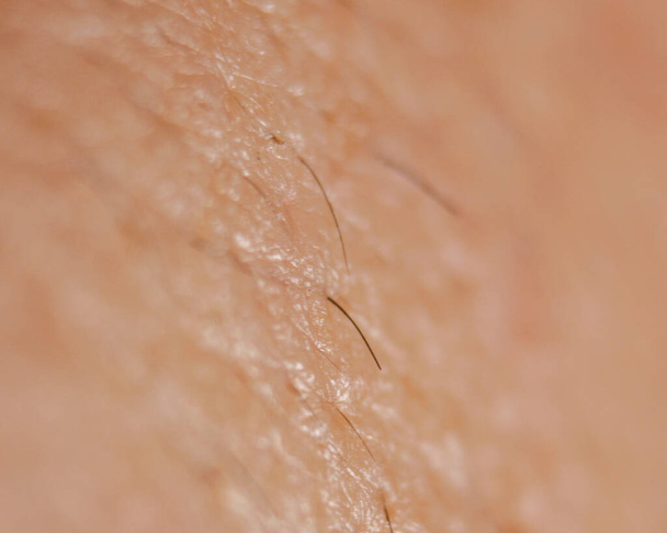 σούπερ μακροεντολή δέρμα και λεπτομέρεια των μαλλιών - Φωτογραφία, εικόνα