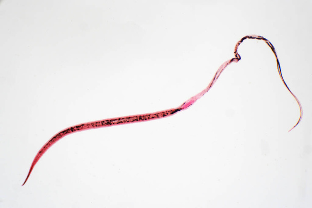 whipworm (Trichuris trichiura) é nematoide helmíntico parasita (lombriga) sob a visão microscópica para a educação
 - Foto, Imagem