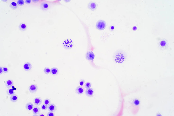 Cromossomas humanos sob visão microscópica para a educação
 - Foto, Imagem