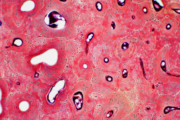 Histologia ludzkiej tkanki kostnej kompaktowej pod mikroskopem widzenia edukacji, połączenia mięśni i tkanki łącznej - Zdjęcie, obraz