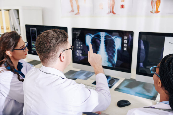 Bir grup doktor düzgün bir teşhis koymaya çalışırken ekranda göğüs röntgenini tartışıyor. - Fotoğraf, Görsel