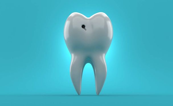 Zub s dírou na modrém pozadí. 3D ilustrace - Fotografie, Obrázek
