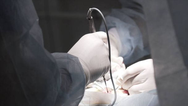 Healthcare workers doing male enhancement surgery. Action. Close up of penis enlargement surgery in operating theater, concept of sex health medicine. - 写真・画像