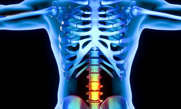 Illustrative image of a human body showing the lumbar part of the vertebrae which present pain and inflammation. 3d render. - 写真・画像
