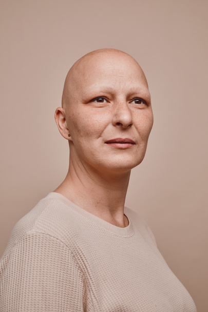 Pionowy, ciepły portret pewnej siebie łysej kobiety odwracającej wzrok, z nadzieją, na minimalnym beżowym tle w studio, łysieniu i świadomości raka - Zdjęcie, obraz