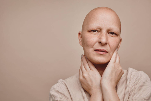 Portrait minimal de la tête et des épaules de la femme chauve regardant la caméra tout en posant sur fond beige en studio, sensibilisation à l'alopécie et au cancer, espace de copie - Photo, image