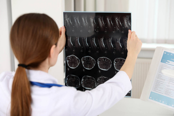 Professional orthopedist examining X-ray picture in her office - Foto, Bild
