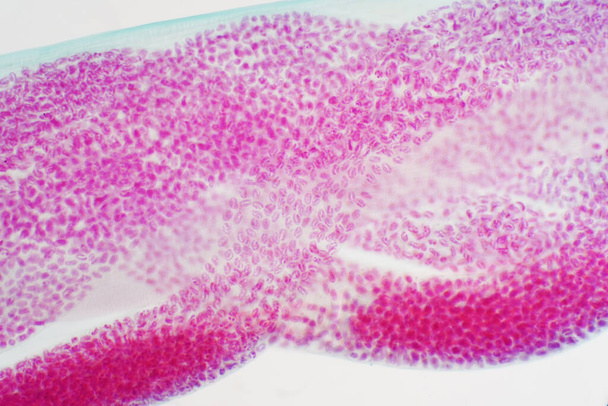 教育のための顕微鏡的視野の下での卵寄生虫(トキソカラカンイス)の顕微鏡像 - 写真・画像