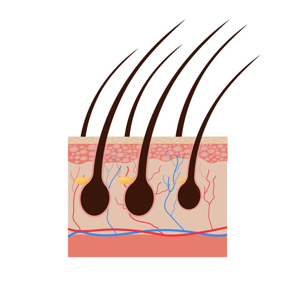 Vektori esimerkki ihmisen hiukset kaavio. Pala ihmisen ihoa ja kaikki rakenne hiukset valkoisella taustalla. Kaljuuntumisen lääketieteellinen hoito, epilaatio käsite. - Vektori, kuva