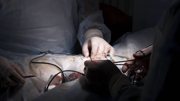 Surgical team operating male genitals in an operation theater. Action. Close up of surgeons removing the tumor from the testicle of a man patient, cancer and medicine concept. - Photo, Image