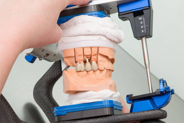 kwaliteitscontrole van een tandimplantaat op een articulator / prosthes - Foto, afbeelding