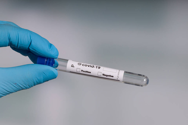 mano en guantes azules sosteniendo un tubo de ensayo vacío delante de un laboratorio - Foto, imagen