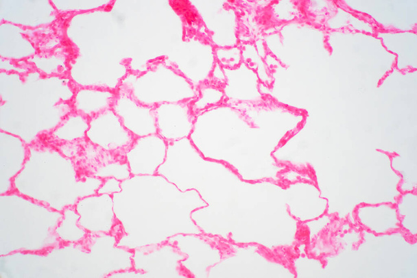 Menselijk longweefsel onder microscoop. Longen zijn de primaire organen van het ademhalingssysteem bij mensen en vele andere dieren. - Foto, afbeelding