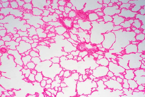 Menselijk longweefsel onder microscoop. Longen zijn de primaire organen van het ademhalingssysteem bij mensen en vele andere dieren. - Foto, afbeelding