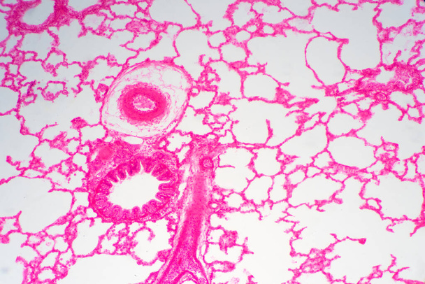 Menschliches Lungengewebe unter dem Mikroskop. Lungen sind die primären Organe der Atemwege bei Menschen und vielen anderen Tieren - Foto, Bild