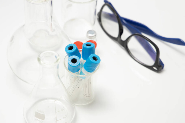 dekantterilasit, silmälasit ja valkoisella pohjalla olevat verinäytteet - Valokuva, kuva