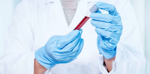 рука врача держит образец трубки крови для анализа и тестирования вирусной болезни в лаборатории, это исследование плазменной биомедицины для диагностической медицинской помощи. - Фото, изображение