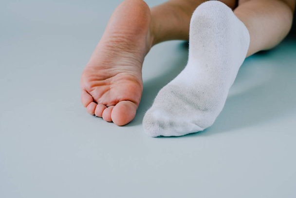 pie derecho en calcetín sucio, pie izquierdo sin calcetines.Aislado sobre fondo gris. Foto de alta calidad - Foto, Imagen