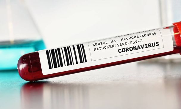 Coronavirus test concept - vial with blood above desk, closeup detail (label is own design, data and barcode are dummy) blurred laboratory glass background - 写真・画像