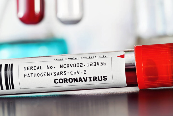 Sample vial with blood, label says coronavirus test (sticker is own design, dummy barcode and data), closeup detail. Blurred laboratory equipment background. Covid-19 outbreak concept - Photo, image