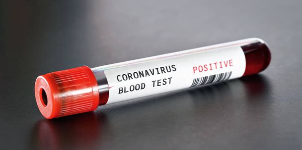 Sample vial with blood on black desk, label says coronavirus test, positive result.  (sticker is own design, dummy barcode) Covid-19 outbreak concept - Foto, afbeelding