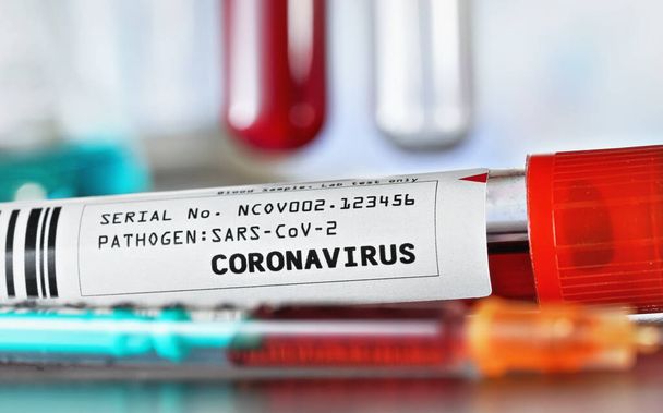Sample vial with blood, label says coronavirus test (sticker is own design, dummy barcode and data), closeup detail. Blurred laboratory equipment background. Covid 19 outbreak concept - Foto, afbeelding