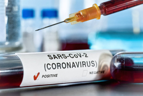 Shallow depth of field photo - sample vial with blood, label sars-cov-2 coronavirus, positive result, syringe above. Blurred laboratory equipment background. Covid-19 testing during outbreak concept - Zdjęcie, obraz
