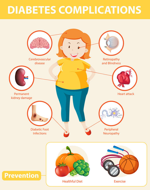 Medizinische Infografik zu Diabetes-Komplikationen und Prävention Illustration - Vektor, Bild