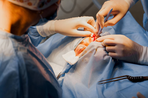 Blefroplastická plastická operace pro úpravu oční oblasti obličeje na lékařské klinice. Dva doktoři dělají plastickou kosmetickou operaci pro ženu. Chirurg provádí řez chirurgickým nožem - Fotografie, Obrázek