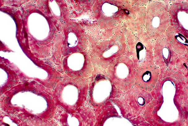 Histología del tejido óseo compacto humano bajo el microscopio para la educación, la conexión del hueso muscular y el tejido conjuntivo - Foto, Imagen