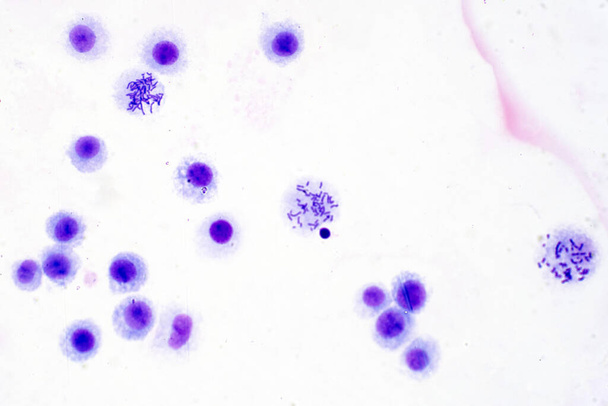 Хромосомы человека из крови под микроскопом для образования. - Фото, изображение