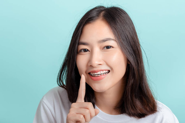 Dental braces of young asian woman wearing braces beauty smile with white teeth increase confidence for healthy on blue background isolated studio shot, Happiness teenager smiling facial expression. - Foto, Imagem