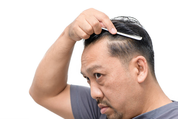 Hombre asiático de mediana edad se preocupan por su pérdida de cabello o alopecia y cabello gris aislado sobre fondo blanco, concepto de cuidado de la salud - Foto, Imagen