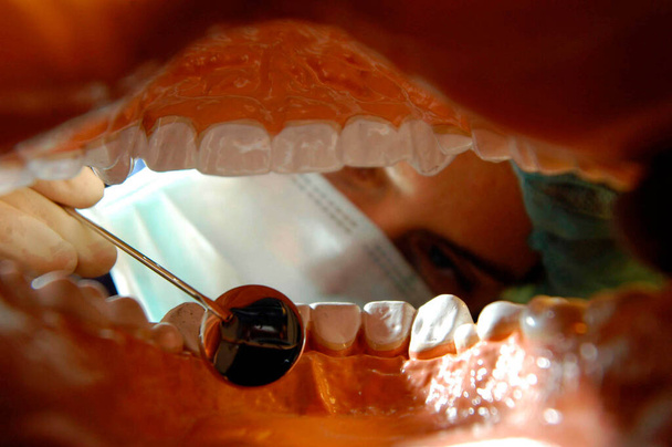 dentysta z lustrem podczas badania stomatologicznego, leczenie stomatologiczne pacjenta - Zdjęcie, obraz