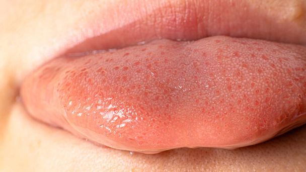 Tongue papillae taste buds and taste. Close up. - Photo, Image