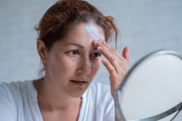 Portrait of a Caucasian woman with vitiligo disease uses sunscreen. A girl with a white pigment spot on her forehead looks in the mirror and is smeared with cream - Фото, изображение