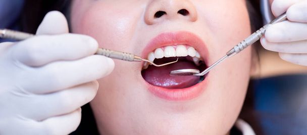 Οδοντιατρική και οδοντιατρική περίθαλψη στην οδοντιατρική κλινική. Οδοντιατρικός έλεγχος δοντιών για νεαρούς Ασιάτες ασθενείς. - Φωτογραφία, εικόνα