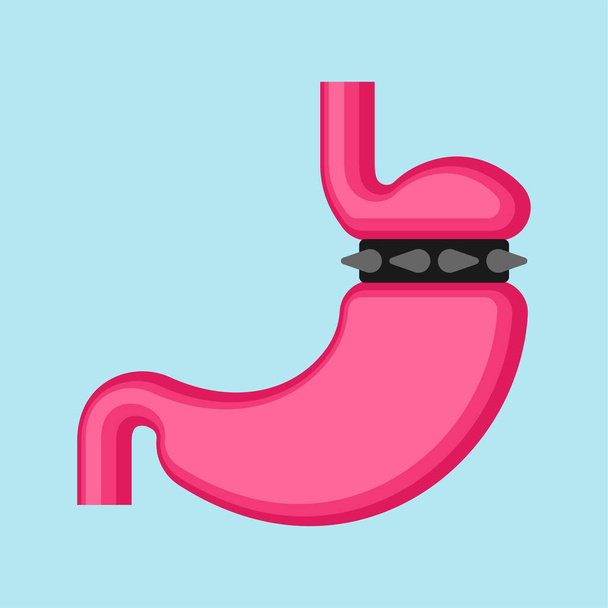 Stomach banding isolated. Adjustable Gastric Band. vector illustration - Vettoriali, immagini