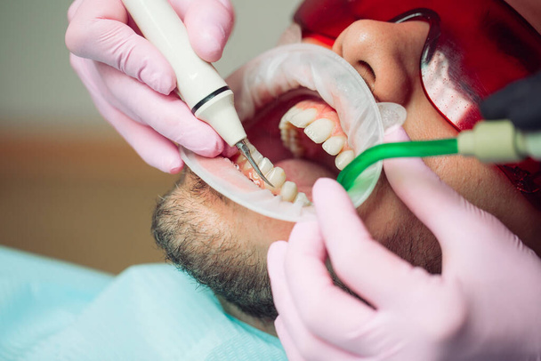 Professional teeth cleaning. Dentist cleans the teeth of a male patient. - Photo, Image
