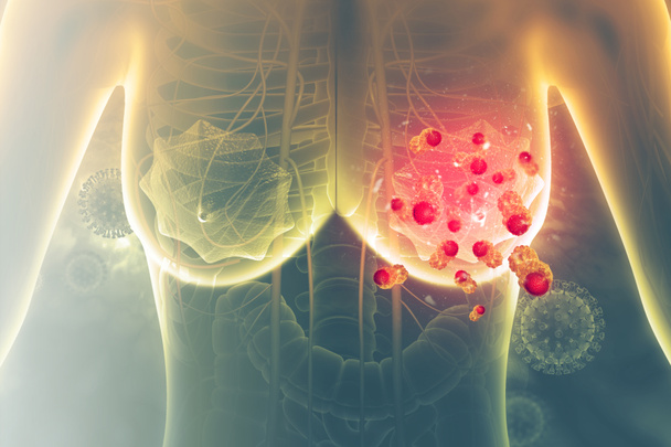 Rakovina prsu. 3D ilustrace - Fotografie, Obrázek