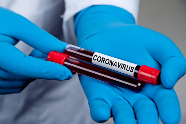 コロナウイルスが発生。流行性ウイルス呼吸器症候群. - 写真・画像