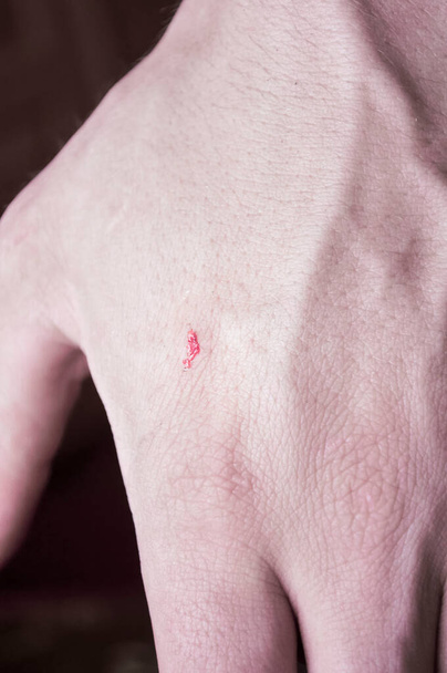 Рука 18-летнего мальчика с небольшой царапиной и выпуклыми венами - Фото, изображение