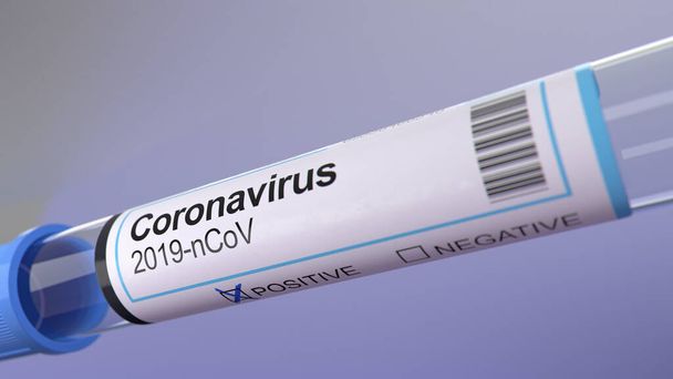 Test na obecność koronawirusów w probówkach kolekcjonerskich Zdjęcie - Rurka do pobierania krwi z etykietą identyfikacyjną koronawirusa z oznaczeniem dodatnim. - Zdjęcie, obraz