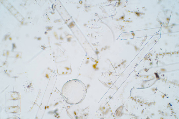 Meerwasserplankton unter dem Mikroskop. - Foto, Bild