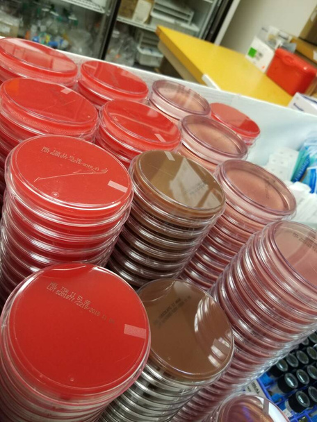 Petri platos con agar sangre, agar chocolate y agar Maconkey - Foto, Imagen