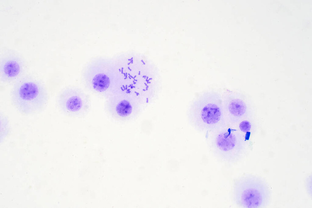 Cromossomas humanos do sangue sob visão microscópica para a educação. - Foto, Imagem